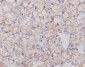 Anti-CA9/Ca Ix Rabbit Monoclonal Antibody